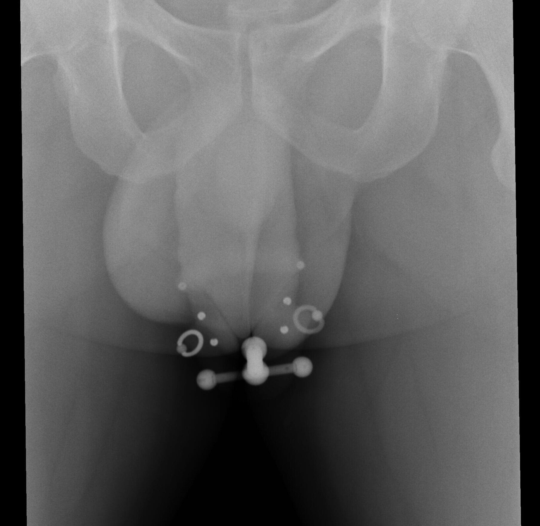 Změny pro pánské genitální piercingy